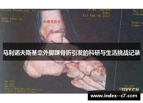 马利诺夫斯基意外脚踝骨折引发的科研与生活挑战记录